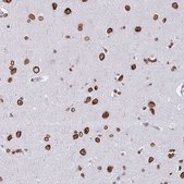 Anti-LMNB2 antibody produced in rabbit Prestige Antibodies® Powered by Atlas Antibodies, affinity isolated antibody, buffered aqueous glycerol solution