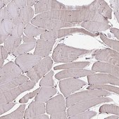 Anti-CHMP1B antibody produced in rabbit Prestige Antibodies® Powered by Atlas Antibodies, affinity isolated antibody, buffered aqueous glycerol solution