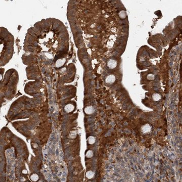 Anti-RABGGTB antibody produced in rabbit Prestige Antibodies&#174; Powered by Atlas Antibodies, affinity isolated antibody, buffered aqueous glycerol solution, Ab1