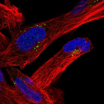 Anti-MVB12B antibody produced in rabbit Prestige Antibodies&#174; Powered by Atlas Antibodies, affinity isolated antibody