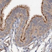 Anti-CEP68 antibody produced in rabbit Prestige Antibodies® Powered by Atlas Antibodies, affinity isolated antibody, buffered aqueous glycerol solution