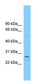 Anti-RCAN1 (N-terminal) antibody produced in rabbit affinity isolated antibody