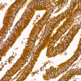 Anti-Clathrin heavy chain Antibody, clone 9M2G2, Rabbit Monoclonal