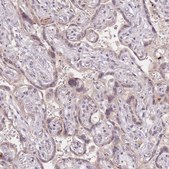 Anti-STK39 antibody produced in rabbit Prestige Antibodies® Powered by Atlas Antibodies, affinity isolated antibody, buffered aqueous glycerol solution