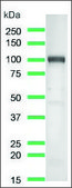 Anti-B7-H3/CD276 antibody, Rabbit monoclonal recombinant, expressed in proprietary host, clone SP206, affinity isolated antibody