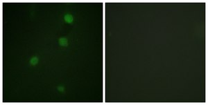 Anti-Retinoblastoma, C-Terminal antibody produced in rabbit affinity isolated antibody