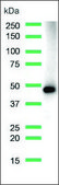 Anti-MAGE-A1 antibody, Rabbit monoclonal recombinant, expressed in proprietary host, clone SP194, affinity isolated antibody