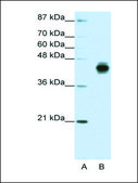 Anti-KRT18 (AB2) antibody produced in rabbit IgG fraction of antiserum