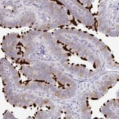 Anti-NME9 antibody produced in rabbit Prestige Antibodies® Powered by Atlas Antibodies, affinity isolated antibody, buffered aqueous glycerol solution