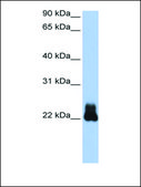 Anti-RHOD (AB1) antibody produced in rabbit affinity isolated antibody