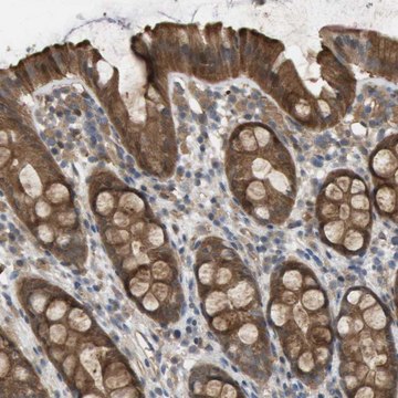 Anti-PALD1 antibody produced in rabbit Prestige Antibodies&#174; Powered by Atlas Antibodies, affinity isolated antibody, buffered aqueous glycerol solution