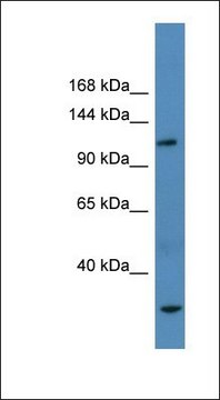 Anti-AP3B1 antibody produced in rabbit affinity isolated antibody