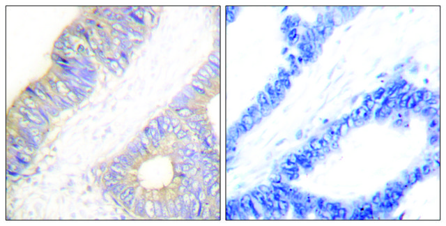 Anti-Stefin A antibody produced in rabbit affinity isolated antibody