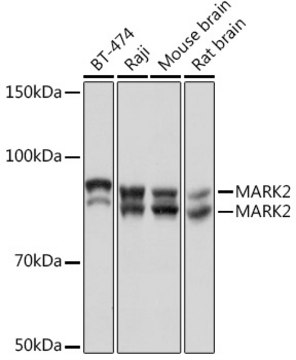 Anti-MARK2 Antibody, clone 6O1C2, Rabbit Monoclonal