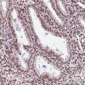 Anti-PRDM5 antibody produced in rabbit Prestige Antibodies® Powered by Atlas Antibodies, affinity isolated antibody, buffered aqueous glycerol solution