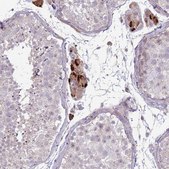 Anti-SLC15A3 antibody produced in rabbit Prestige Antibodies® Powered by Atlas Antibodies, affinity isolated antibody, buffered aqueous glycerol solution