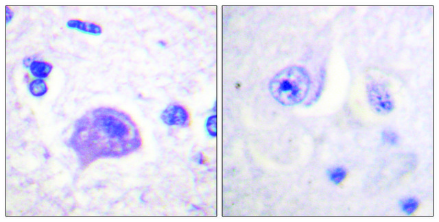 Anti-HRS antibody produced in rabbit affinity isolated antibody