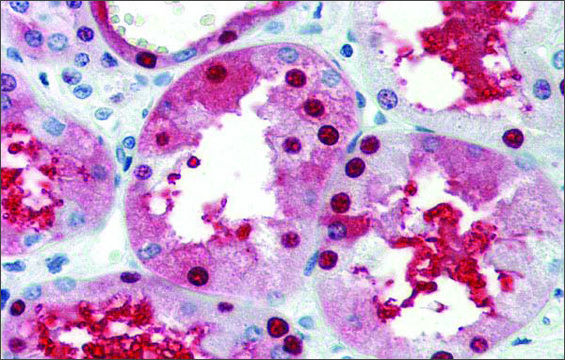 Anti-GATA3 antibody produced in rabbit affinity isolated antibody