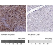 Anti-APOBR antibody produced in rabbit Prestige Antibodies® Powered by Atlas Antibodies, affinity isolated antibody, buffered aqueous glycerol solution