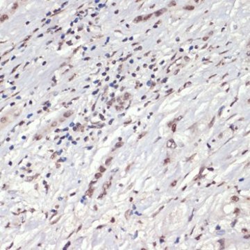 Anti-Phospho-Jak2-Y1007/1008 antibody produced in rabbit