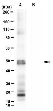 Anti-Nebulin exon 143 Antibody, clone NEB-3F4