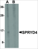 Anti-SPRYD4 antibody produced in rabbit affinity isolated antibody