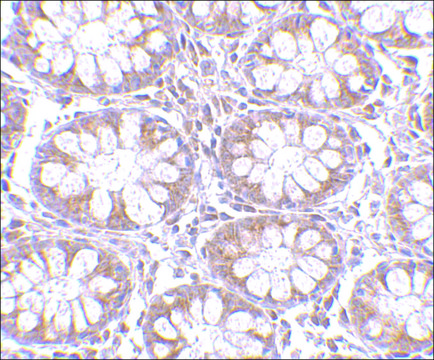 Anti-TEM1 (ab1) antibody produced in rabbit affinity isolated antibody, buffered aqueous solution