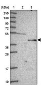 Anti-FECH antibody produced in rabbit Prestige Antibodies® Powered by Atlas Antibodies, affinity isolated antibody, buffered aqueous glycerol solution