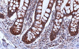 Anti-LLGL2 Antibody, clone 2H12 ZooMAb® Rabbit Monoclonal recombinant, expressed in HEK 293 cells
