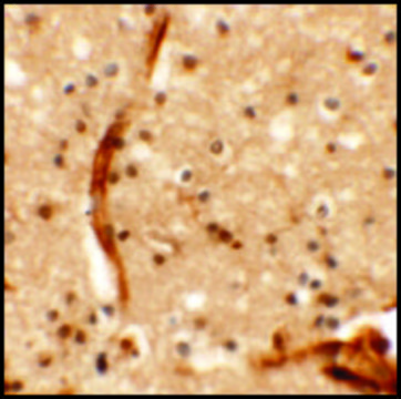 Anti-KCNK13 antibody produced in rabbit affinity isolated antibody