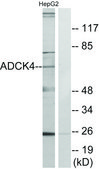 Anti-ADCK4 antibody produced in rabbit affinity isolated antibody