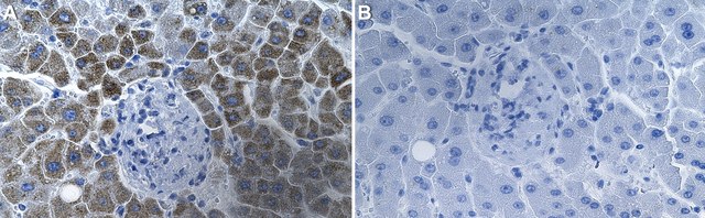 Anti-CCL20/MIP-3&#945; Antibody, clone 1F5-H1 ZooMAb&#174; Rabbit Monoclonal recombinant, expressed in HEK 293 cells