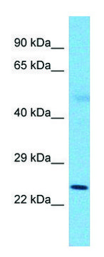 Anti-SLC25A26 (N-terminal) antibody produced in rabbit affinity isolated antibody