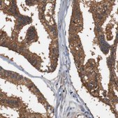 Anti-LRP4 antibody produced in rabbit Prestige Antibodies® Powered by Atlas Antibodies, affinity isolated antibody, buffered aqueous glycerol solution