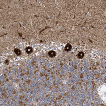 Anti-ITM2B antibody produced in rabbit Prestige Antibodies&#174; Powered by Atlas Antibodies, affinity isolated antibody, buffered aqueous glycerol solution