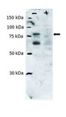 Anti-PCSK9 Antibody from rabbit, purified by affinity chromatography