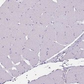 Anti-CCNO antibody produced in rabbit Prestige Antibodies® Powered by Atlas Antibodies, affinity isolated antibody, buffered aqueous glycerol solution