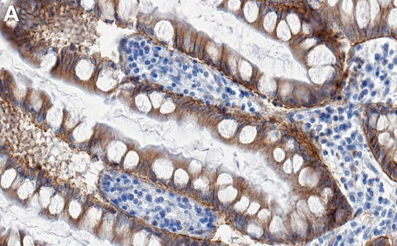 Anti-Integrin &#946;4 Antibody, clone 3D11 ZooMAb&#174; Rabbit Monoclonal recombinant, expressed in HEK 293 cells