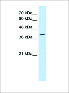 Anti-WNT2B antibody produced in rabbit affinity isolated antibody