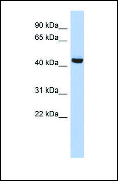 Anti-EXOC4, (N-terminal) antibody produced in rabbit affinity isolated antibody