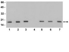 Anti-phospho-Histone H3 (Thr11) Antibody, clone MC83, rabbit monoclonal culture supernatant, clone MC83, Upstate®