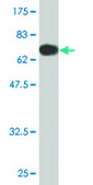 Monoclonal Anti-LIPA antibody produced in mouse clone 1F9, purified immunoglobulin, buffered aqueous solution