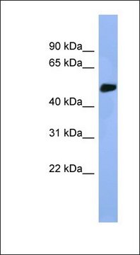 Anti-STK25 antibody produced in rabbit affinity isolated antibody