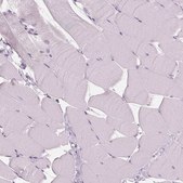 Anti-DNASE2 antibody produced in rabbit Prestige Antibodies® Powered by Atlas Antibodies, affinity isolated antibody, buffered aqueous glycerol solution