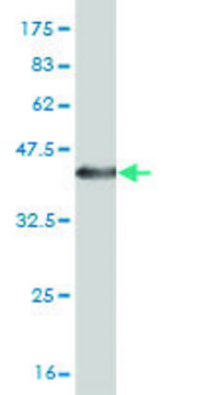 Monoclonal Anti-CDH6 antibody produced in mouse clone 2F2, purified immunoglobulin, buffered aqueous solution