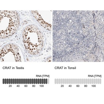 Anti-CRAT antibody produced in rabbit Prestige Antibodies&#174; Powered by Atlas Antibodies, affinity isolated antibody, buffered aqueous glycerol solution, Ab2