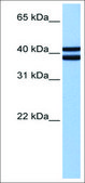 Anti-RAX (AB2) antibody produced in rabbit affinity isolated antibody