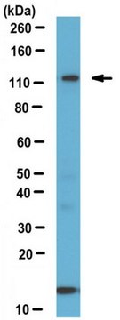 Anti-GPR56, C-terminal Antibody from rabbit, purified by affinity chromatography