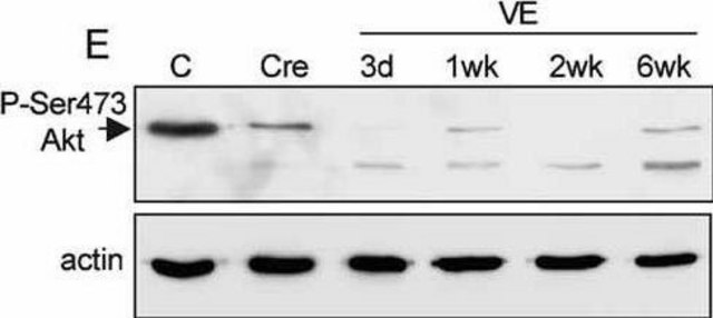 Anti-Actin, N-terminal antibody produced in rabbit ~0.5&#160;mg/mL, affinity isolated antibody, buffered aqueous solution