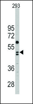 Anti-CHRD (C-term) antibody produced in rabbit affinity isolated antibody, buffered aqueous solution